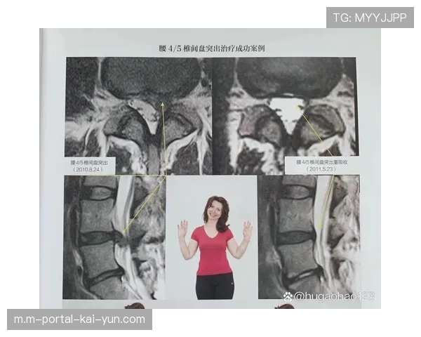 梁靖崑因腰腿旧伤连续退赛 医疗评估显示腰椎间盘突出达五毫米